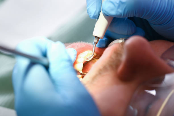 Best Emergency Dental Services for Seniors in North Fair Oaks, CA