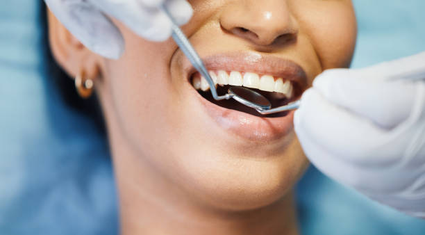 Best Weekend Emergency Dentist in North Fair Oaks, CA